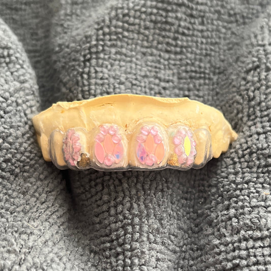 GALAHKDIK AURA™ Pink Empress Tooth Adornment Maxillary