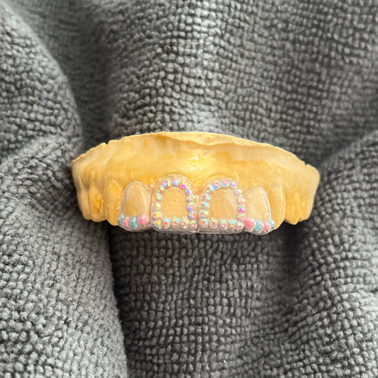 GALAHKDIK AURA™ Rhine Thy Rim Tooth Adornment Maxillary